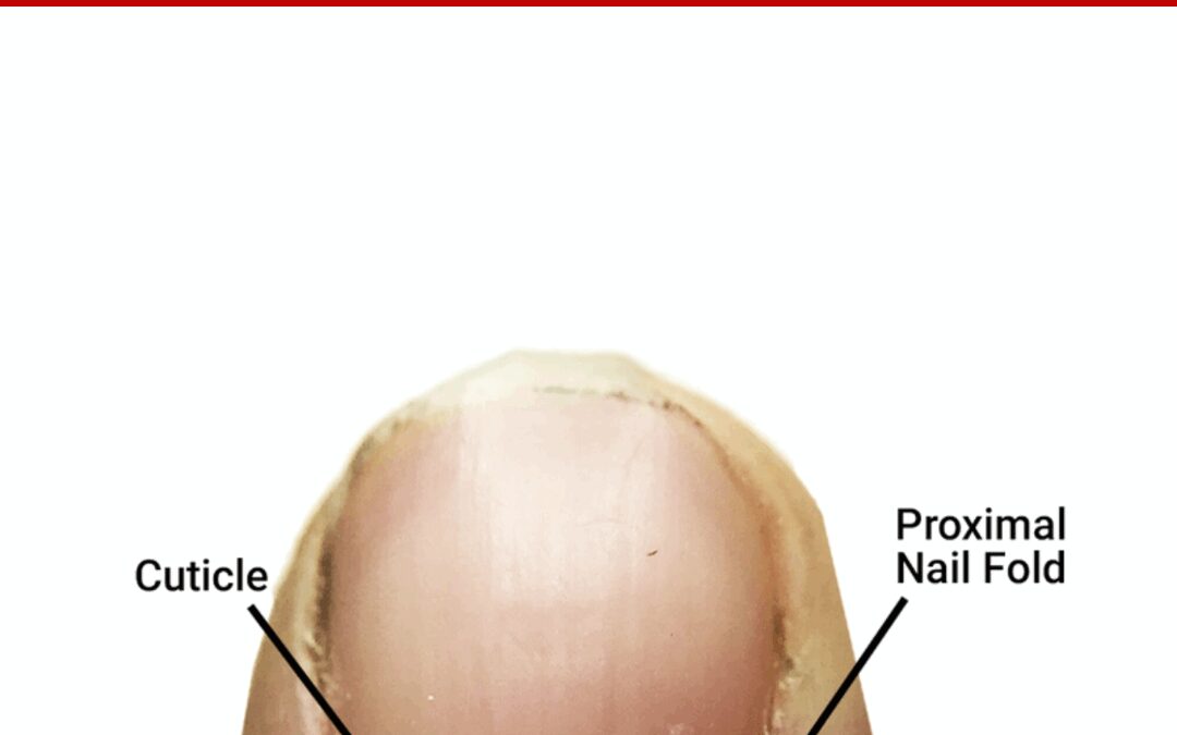 The Cuticle – Should You Clip, Push, or Scrape?