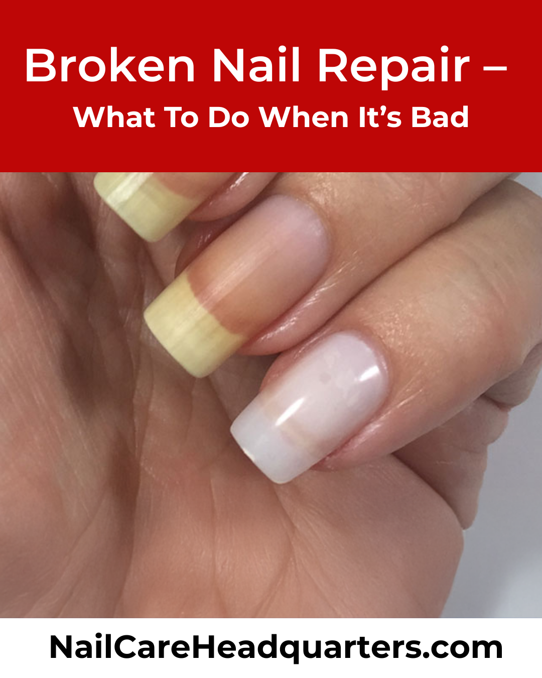 Broken-nail-repair-article-meme