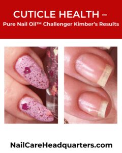 Cuticle-Health-Kimbers-TH