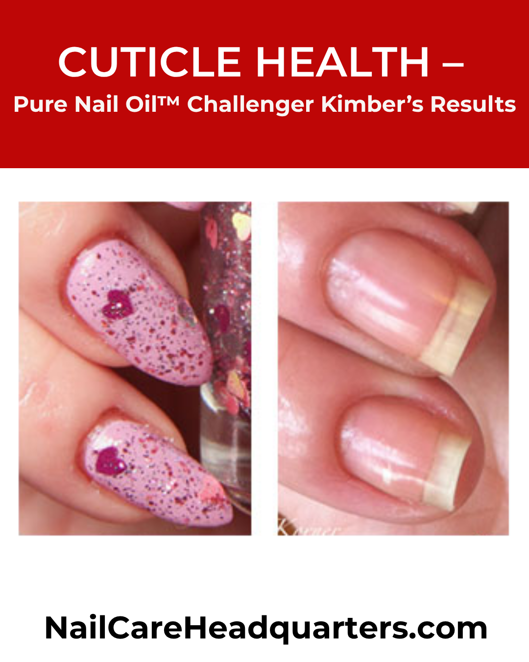 Cuticle-Health-Kimbers-TH