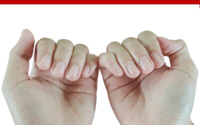 ASK DOUG: Nail Growth – How Do Fingernails Grow?