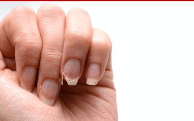 How to Stop Breaking Nails