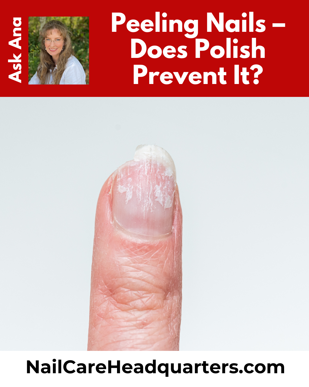 www.NailCareHQ.com - ASK ANA: Peeling Nails - Does Polish Prevent It? Ana addresses how peeling happens and whether polish can help prevent it. Read on ...