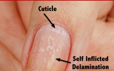 Does Picking Polish Cause Damage?