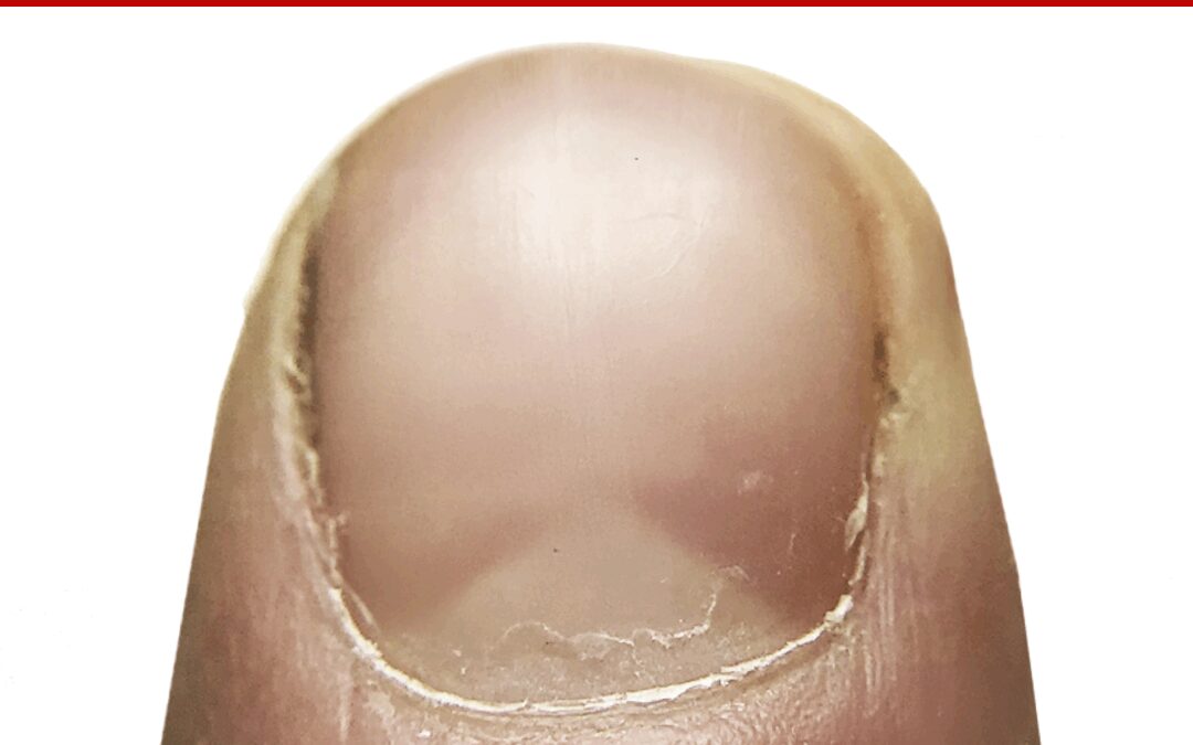 Should You Remove Cuticles?