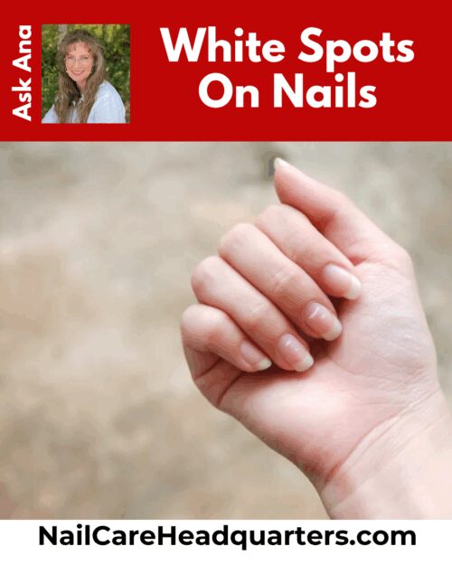 white-spots-on-nails-nailcarehq