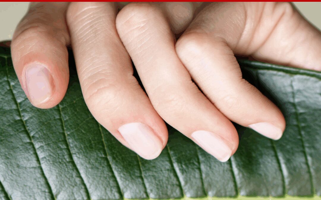3 Reasons Why Short Nails Peel More