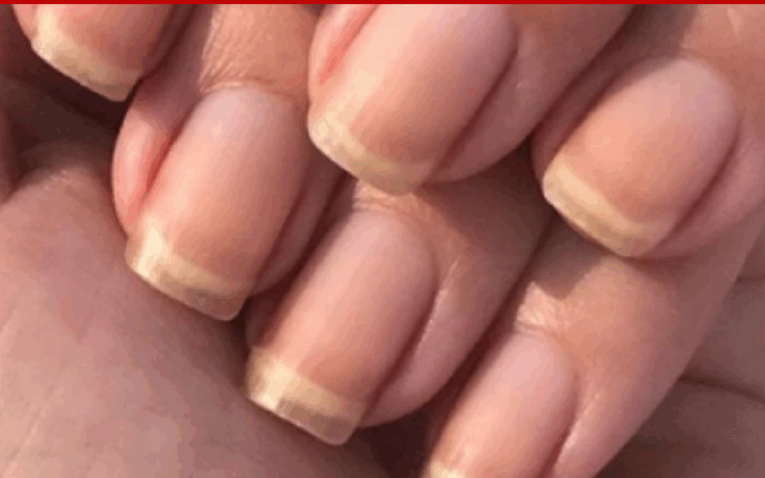 Clear Fingernails – Is It a Bad Thing?