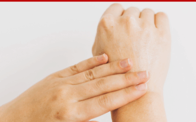 Ask Ana – How Do I Stop Hard, Dry Skin On Hands?