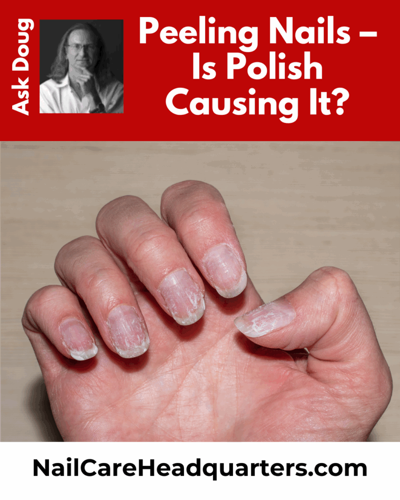 Is polish causing my nails to peel? 