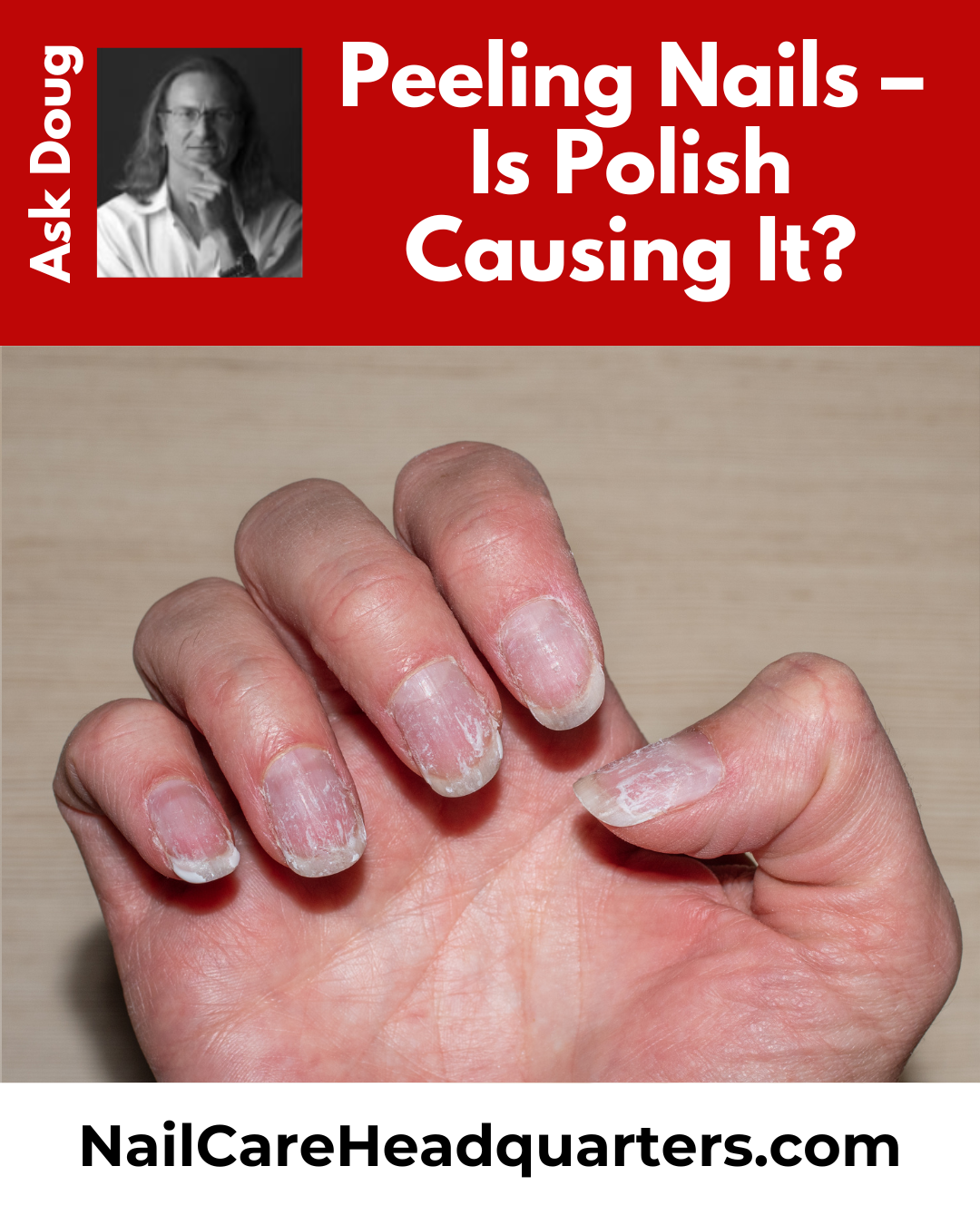 Is polish causing my nails to peel?