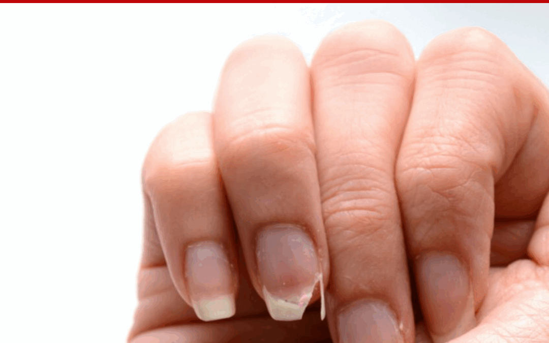 How to Fix a Broken Nail