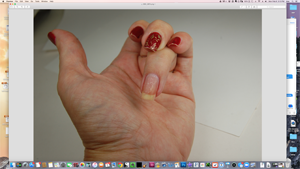 Does Picking Polish Cause Damage